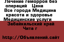 Лечение геморроя без операций › Цена ­ 300 - Все города Медицина, красота и здоровье » Медицинские услуги   . Забайкальский край,Чита г.